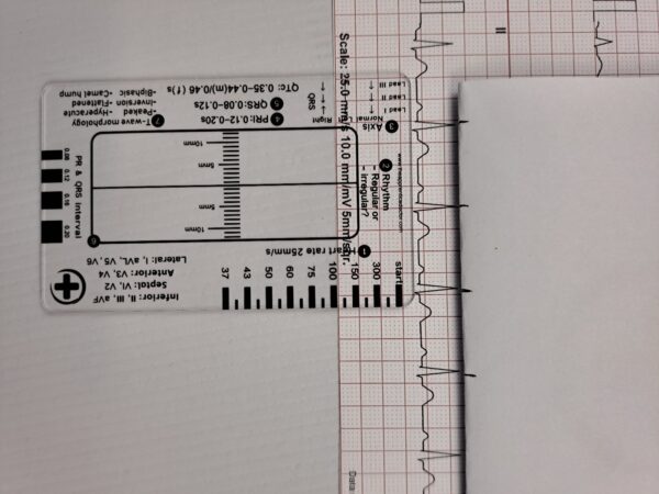 ECG Card for Cardiology Course on Academy - Image 6