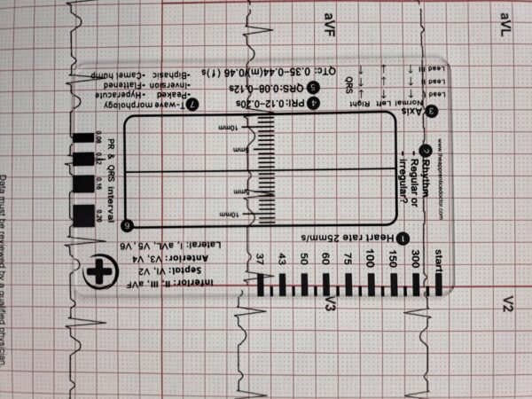 ECG Card for Cardiology Course on Academy - Image 10